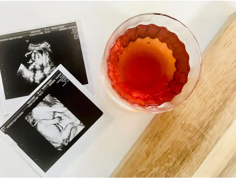 妊娠中は紅茶禁止 カフェインが赤ちゃんに与える影響とは Linktea ネパール紅茶